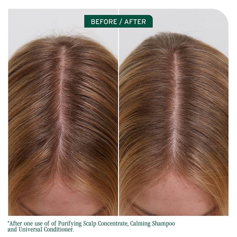 Biolage - Scalp Sync - Concentré Purifiant Cuir Chevelu (200ml)