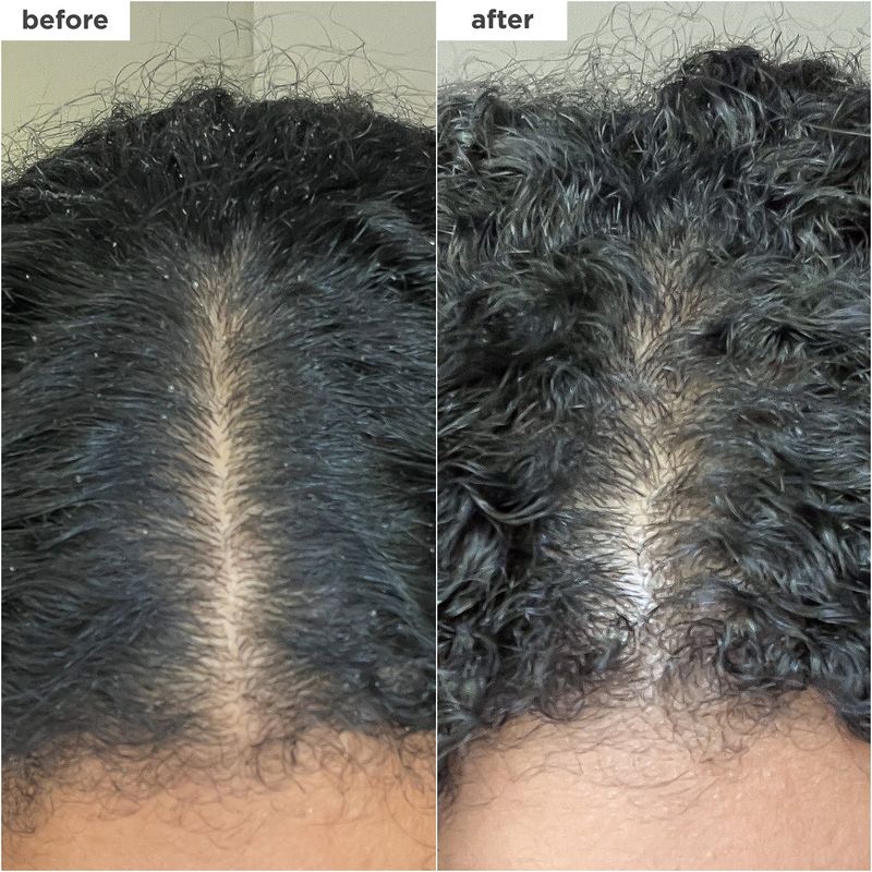 Briogeo – Scalp Revival – Shampoing Exfoliant Charbon + Coco – 60ml