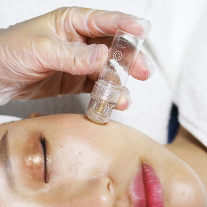 mesotherapy at home