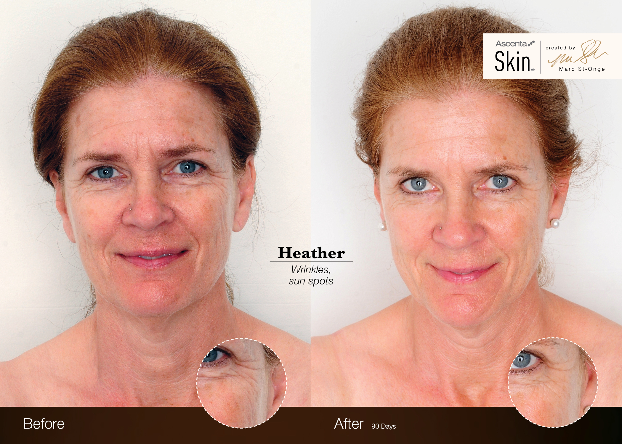 Bend Skin Gel Caps (formerly Ascenta skin care) – Bend Skincare (formerly  Ascenta Skin) – Raintree Wellness Spa