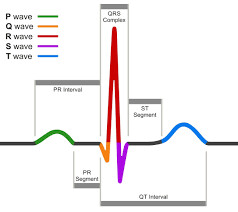 BASIC 12 LEAD ECG INTERPRETATION TIPS &amp; TRICKS
