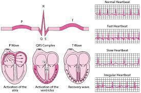 ECG for ACLS Workshop