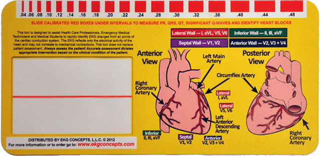 R-CAT Window for STEMI