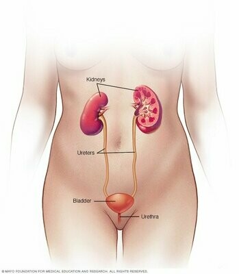 Urinary tract infections support