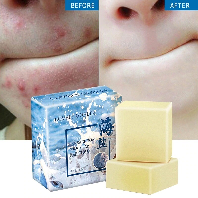 Acne Treatment Soap Sea Salt Goats Milk Moisturizing 100g Sydney Acne Treatment Soap Sea Salt Goats Milk Moisturizing 100g Sydney