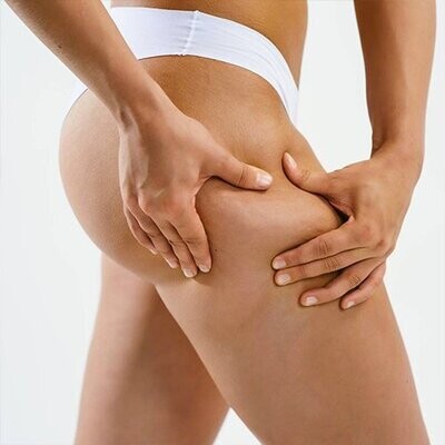 Trattamento corpo Cellulite