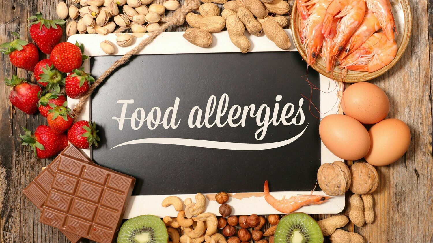 Comprehensive Food Allergy Panel Comprehensive Food Allergy Panel