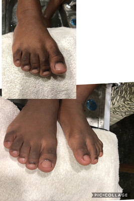 Children Pedicure