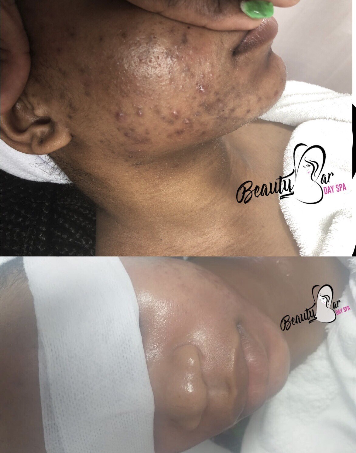 Intense Facial