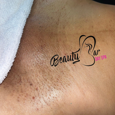 Brazilian Wax
