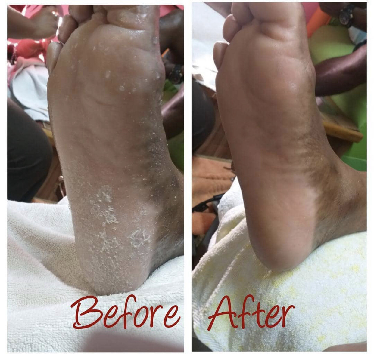 Men Spa Pedicure