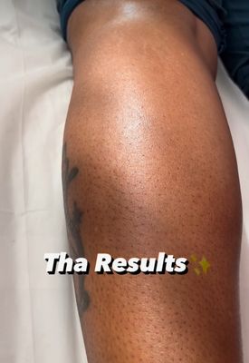 Full Leg Wax