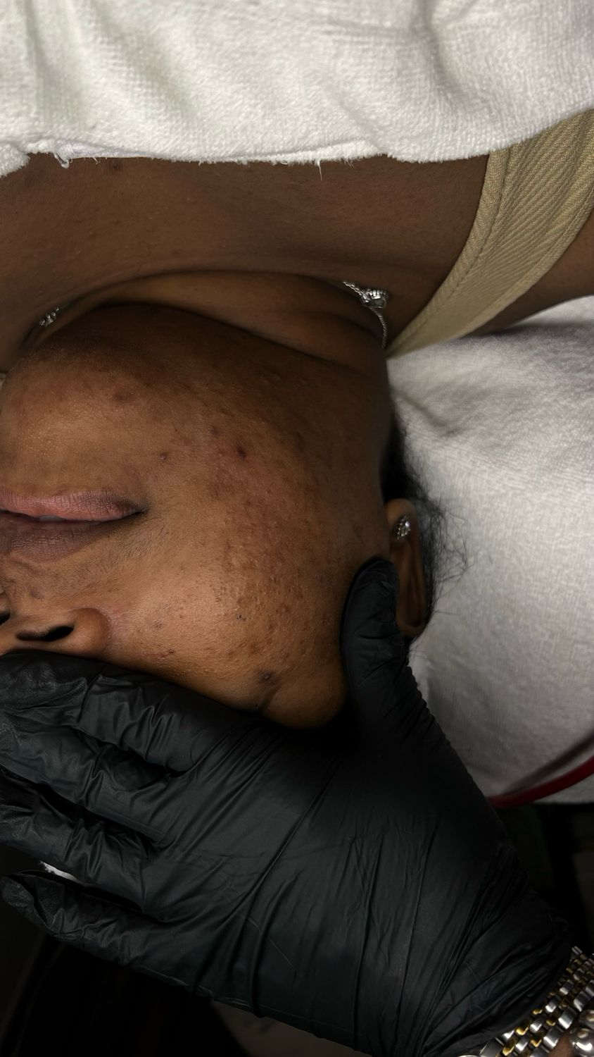 First Time Bb Facial Treatment