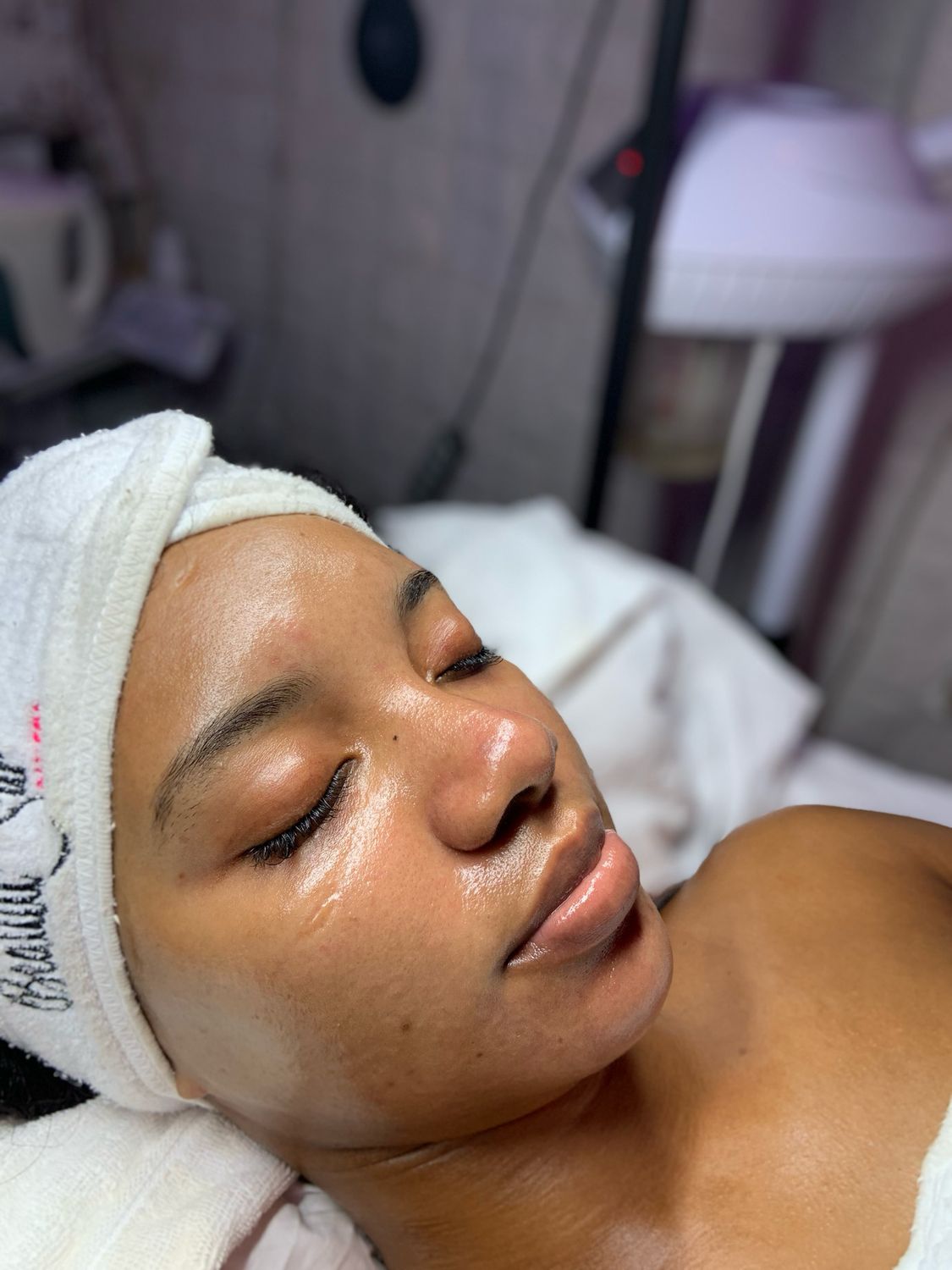 Chemical Peel (Level 1)