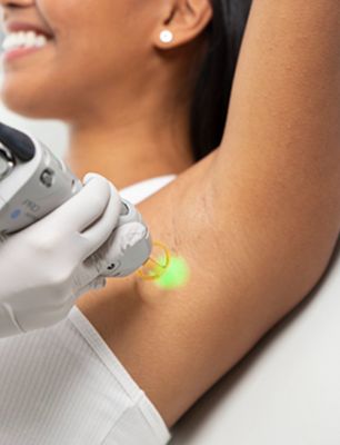 Underarm Laser Reduction