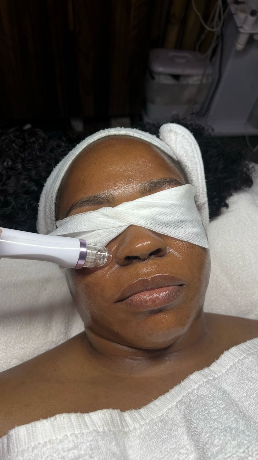 Hydro dermabrasion Facial