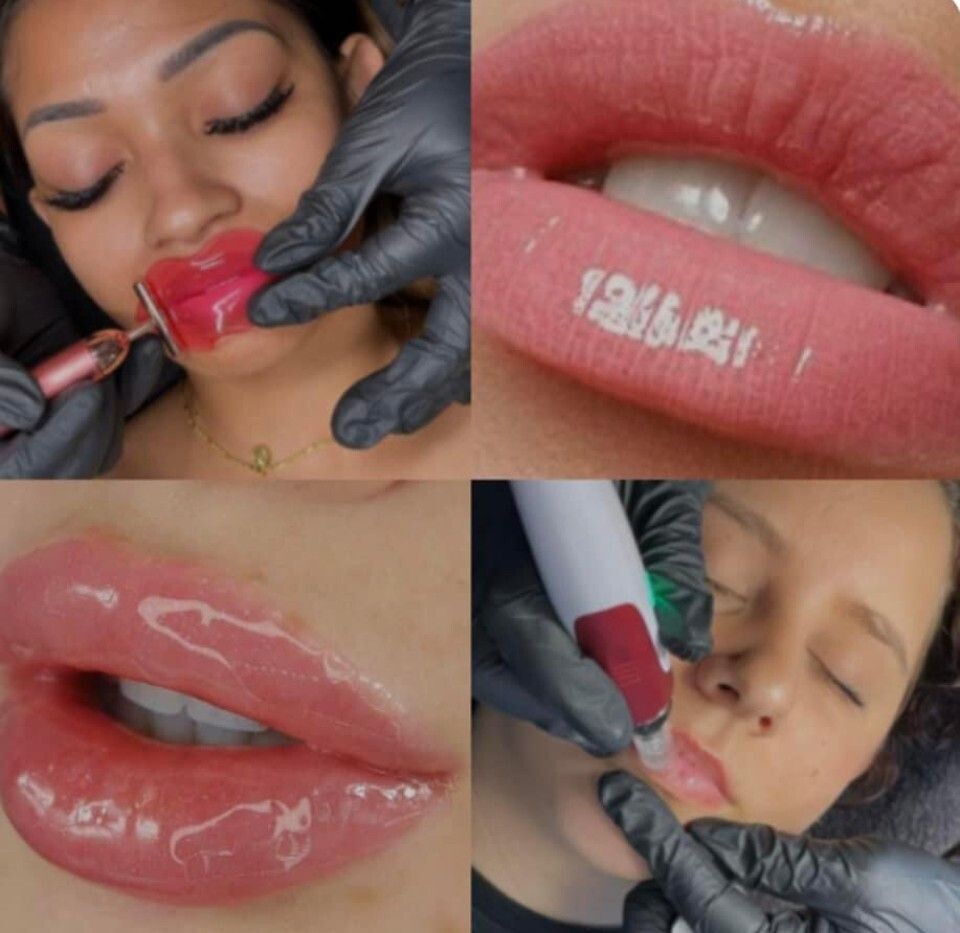 Hydra Lip Course