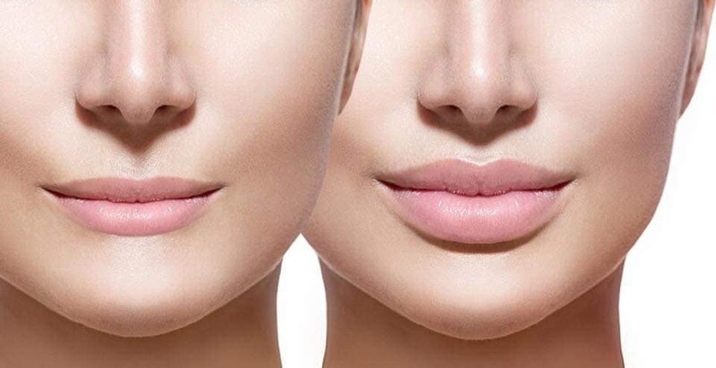 Combined Dermal Filler and First Aid Pay in full