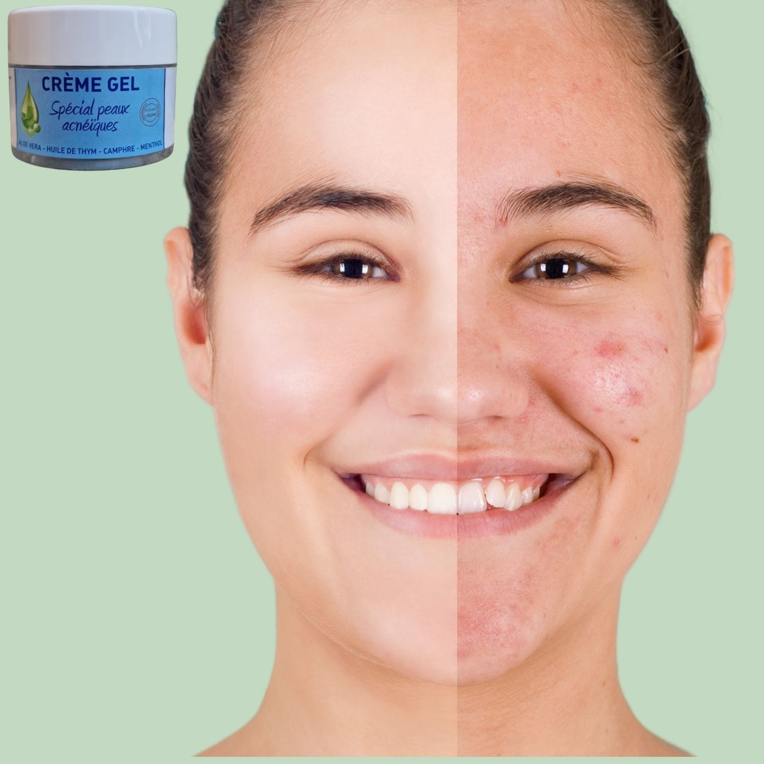 Crème-Gel Aloe Vera - Spécial Peaux Grasses