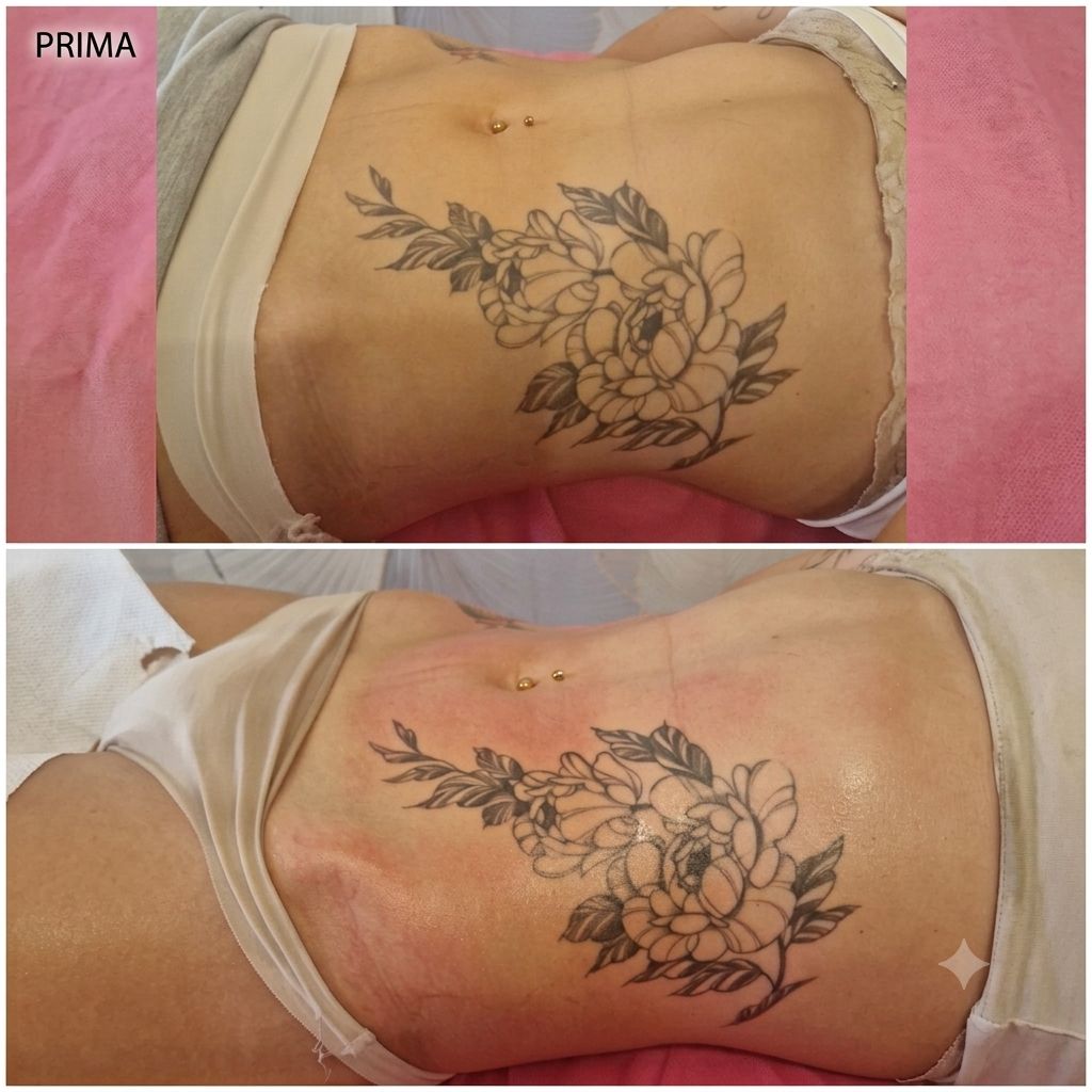 PANCIA PIATTA