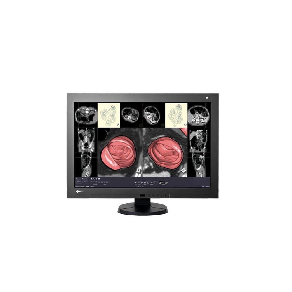 LCD EIZO 29.8&quot; RadiForce RX430; black;2560x1600, 1100:1, 400cd/m2, DVI, DisplayPort, USB Hub, AG
