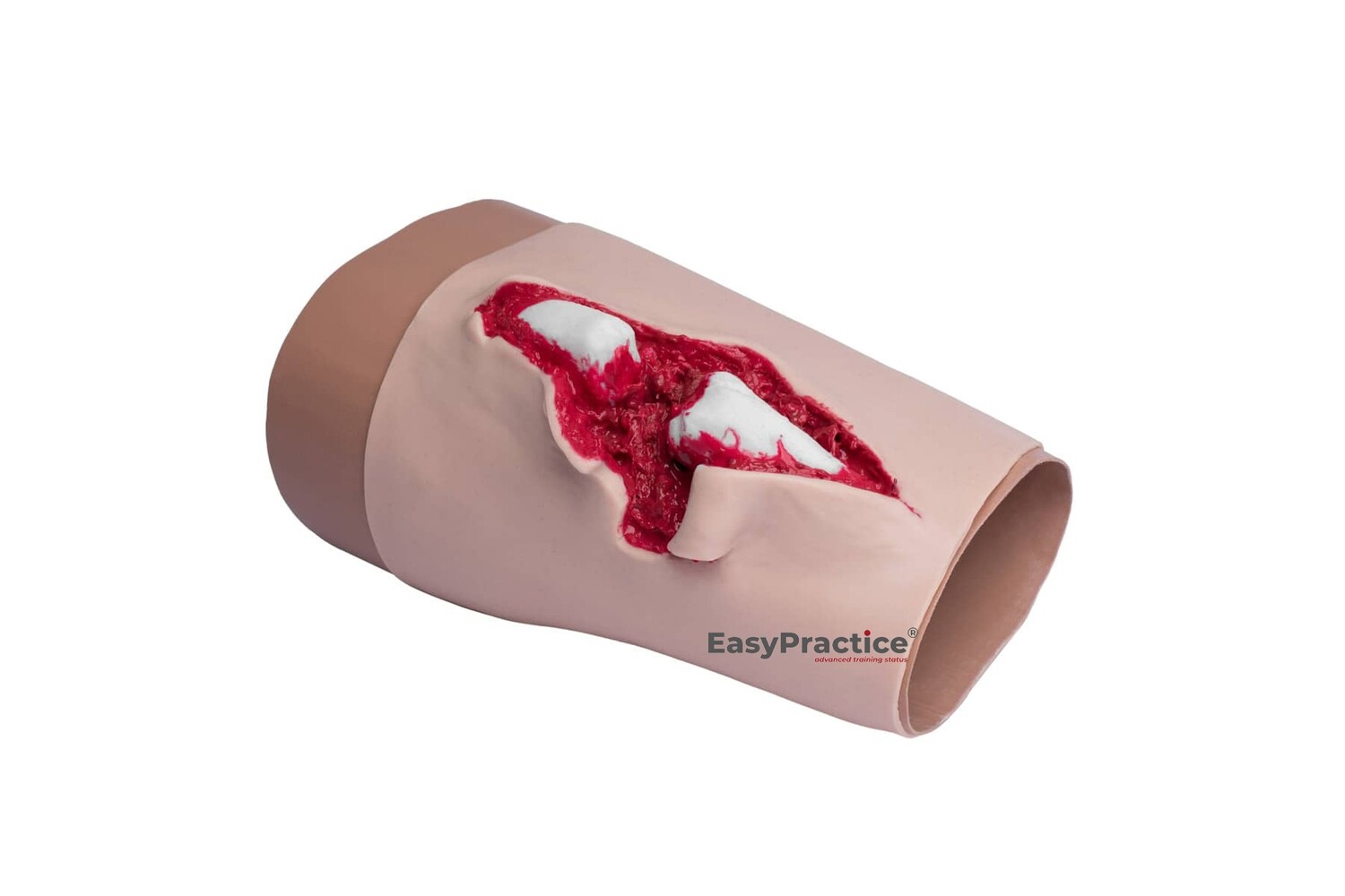 Plaie blessure Fracture
