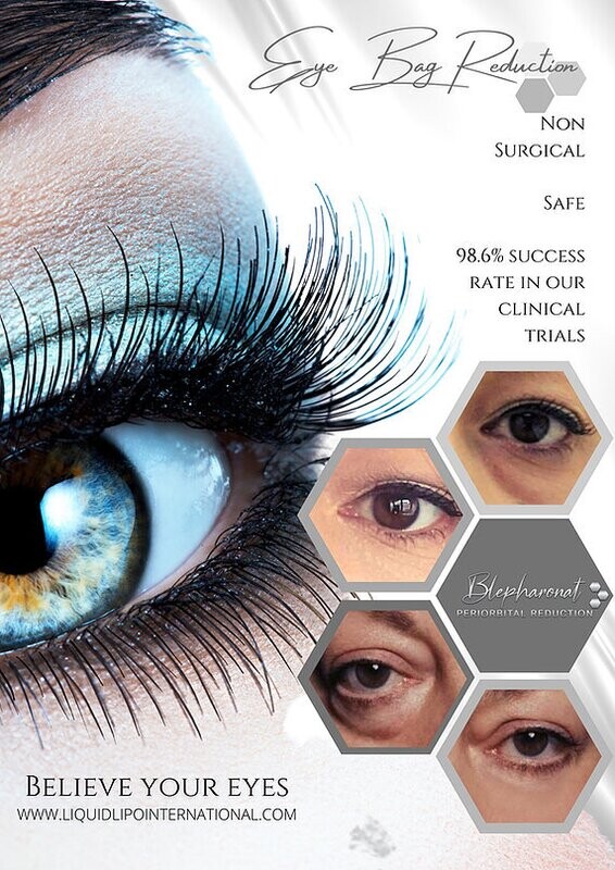 Blepharonat Peri Orbital Reduction