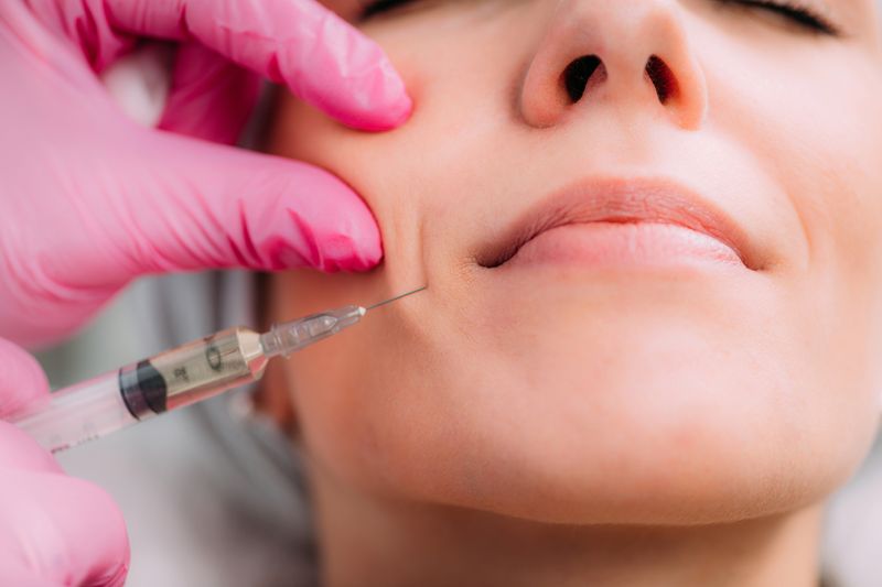 Dermal Fillers
