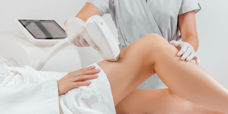 LASER HAIR REMOVAL