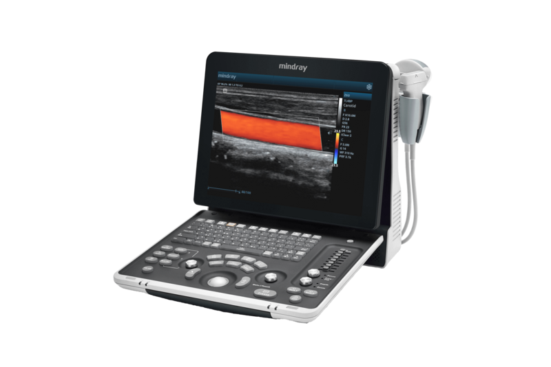 Mindray Z60