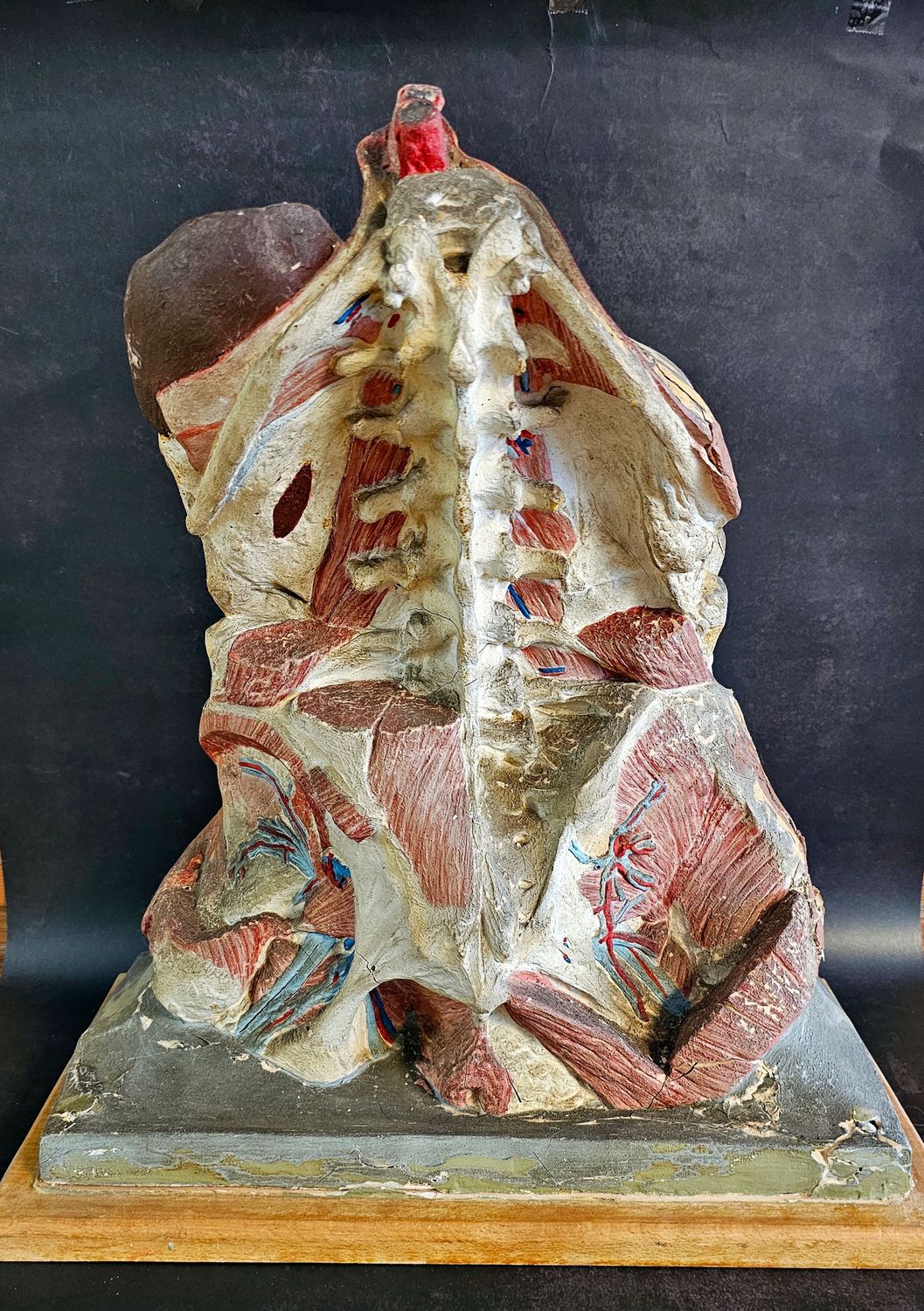 VERY RARE FRENCH ANATOMICAL ABDOMINAL ORGANS AZOUX / AUGIER NICOLAS R. 1919-1939