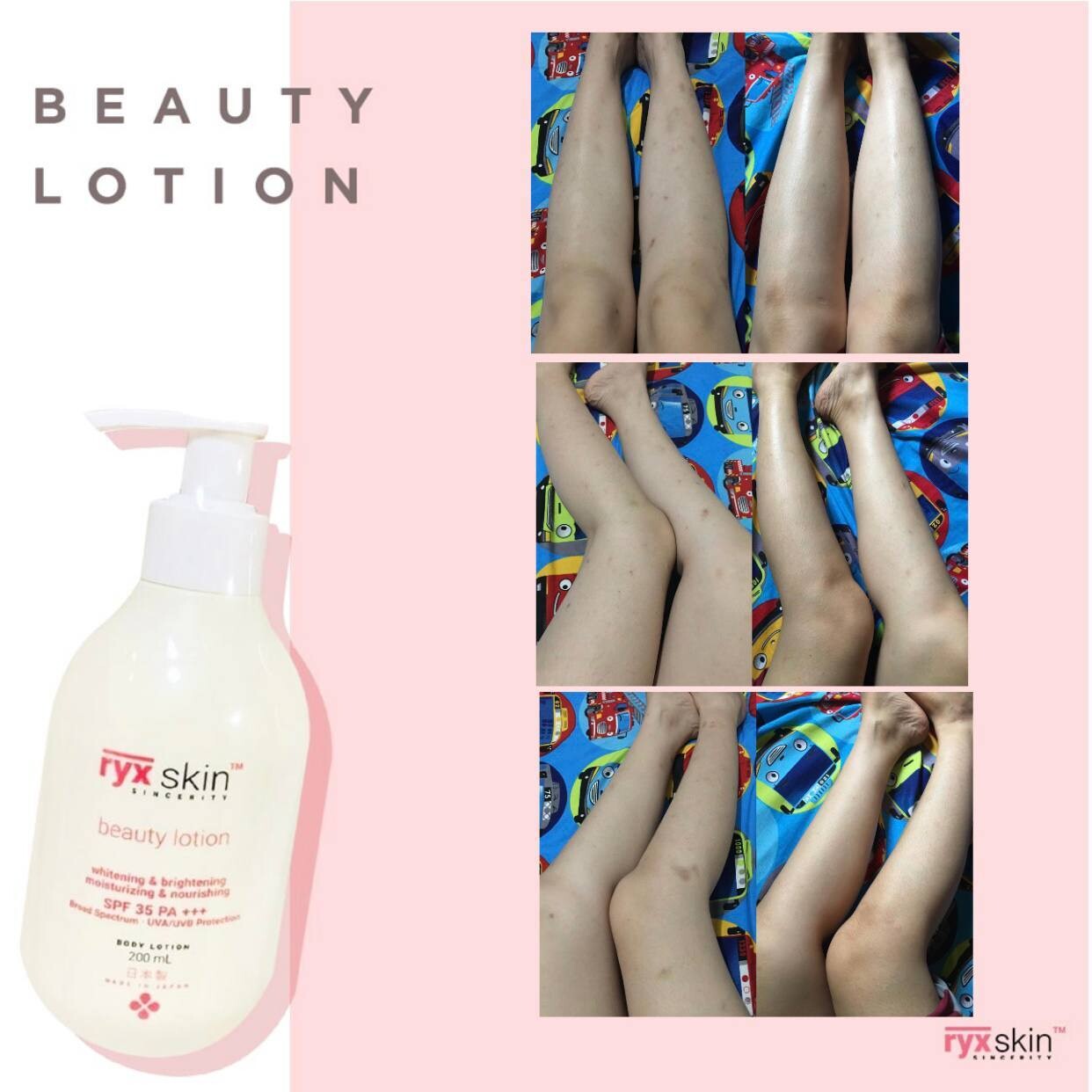 Ryxskin Whitening Lotion ( BBD DEC 10.2026)