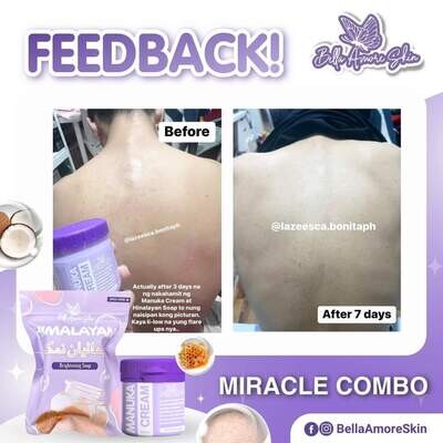 BELLA AMORE HIMALAYA SOAP (BBD june 23,2027)