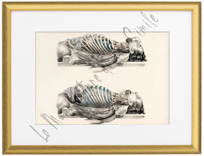 DISSECTION CAGE THORACIQUE 1, 2 et 3