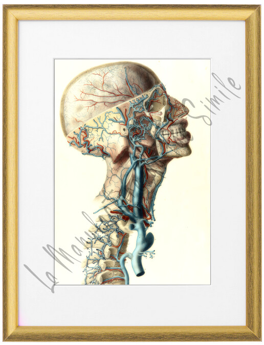 COUPE CRANE HUMAIN VASCULARITE