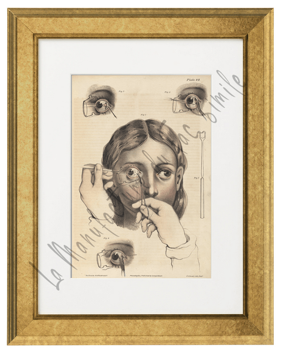 CHIRURGIE DE L'OEIL