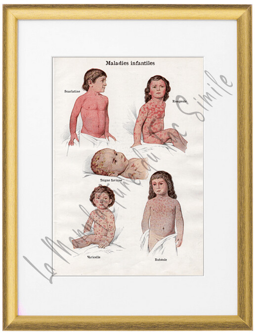 MALADIES INFANTILES