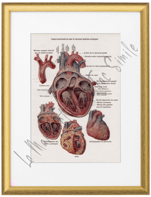 CŒUR ET MALADIES CARDIAQUES