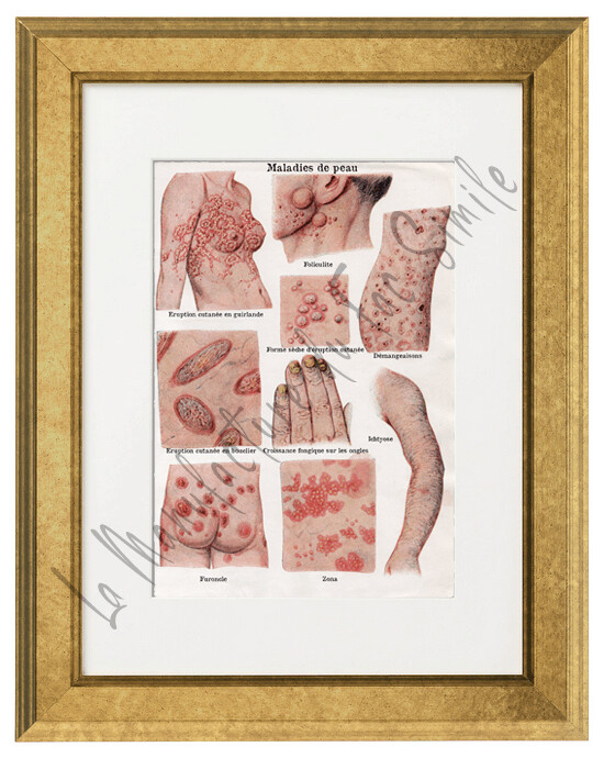 MALADIES DE PEAU