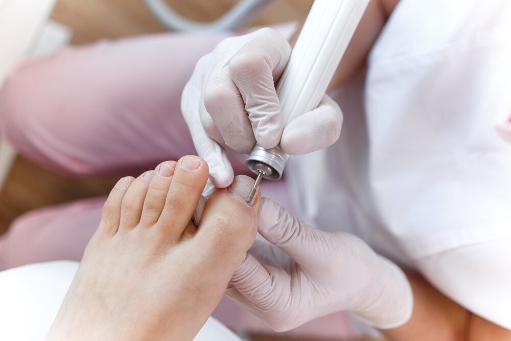 Medische pedicure met voetmasker en gellak Medische pedicure met voetmasker en gellak