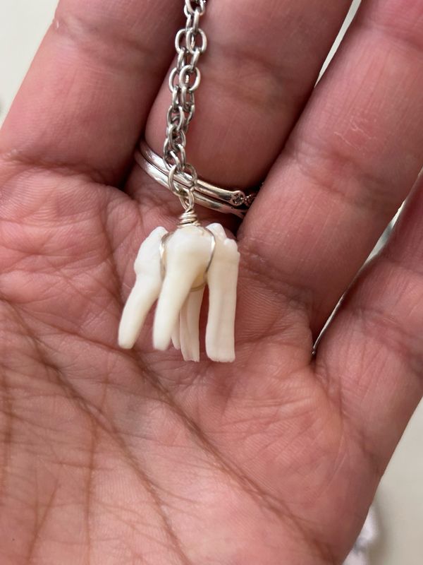 Pigs Tooth Choker Necklace
