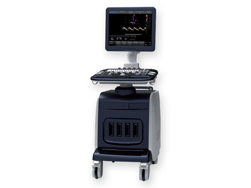 CHISON i8 ECOCOLOURDOPPLER