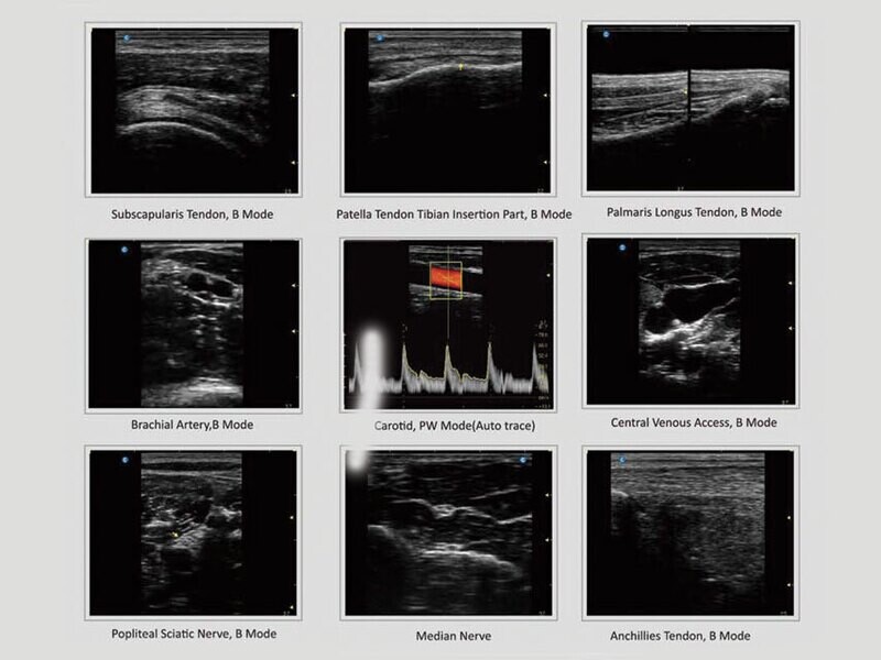 SONOTOUCH 30 ULTRASOUND - Colour