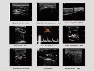 SONOTOUCH 30 ULTRASOUND - Colour