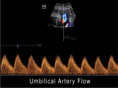 MINDRAY Z5 COLOUR ULTRASOUND with 2 probe connectors