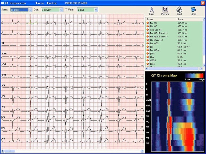 PC-ECG + CARDIOLOGY SOFTWARE
