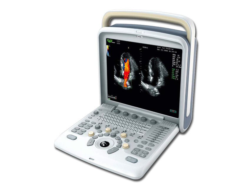 CHISON Q5 PORTABLE COLOURDOPPLER