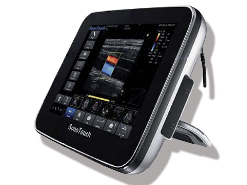 SONOTOUCH 30 ULTRASOUND - Colour