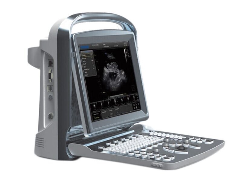 CHISON ECO 1 VET ULTRASOUND