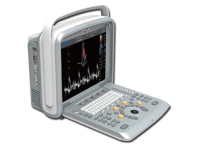 CHISON Q9 PORTABLE COLOURDOPPLER + 4D PROBE AND SOFTWARE